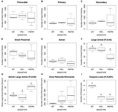 Fragile X Associated Primary Ovarian Insufficiency (FXPOI): Case Report and Literature Review